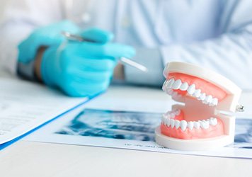 Dentist in blue gloves examining patient’s x-ray at desk with toy teeth